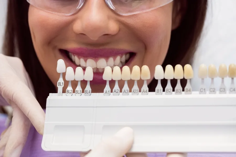 Lentes de contato dental e facetas em porcelana na Belle Dent, em Ibipeba